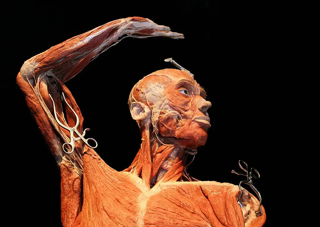 Body Worlds is arguably Amsterdam's most controversial museum (Fred Duval/FilmMagic)