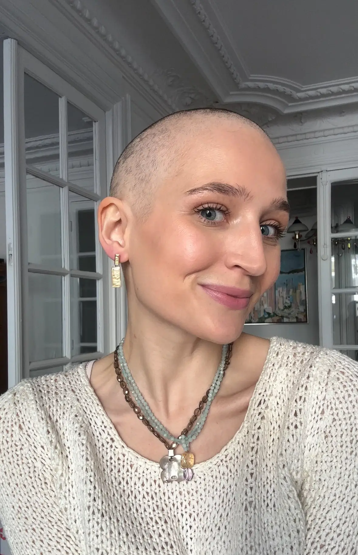 Marly began her chemotherapy back in March (SWNS)