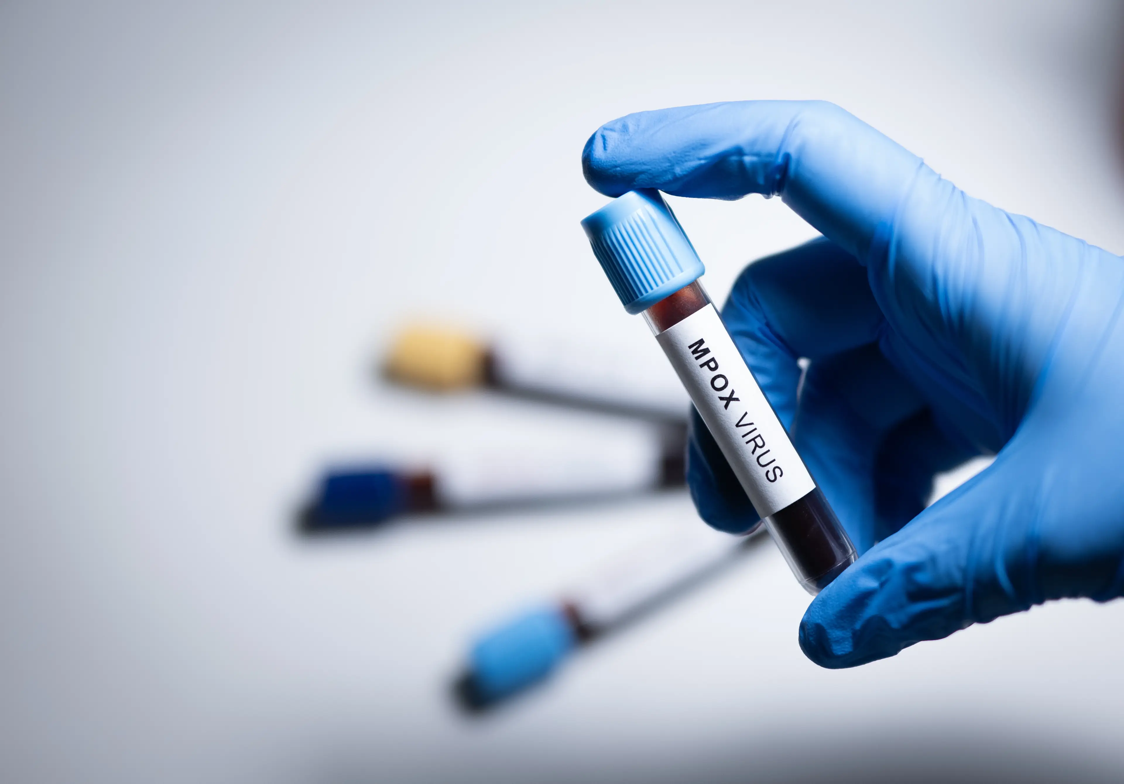 The vaccine is available in the UK for at risk groups (Hakan Nural/Anadolu via Getty Images)