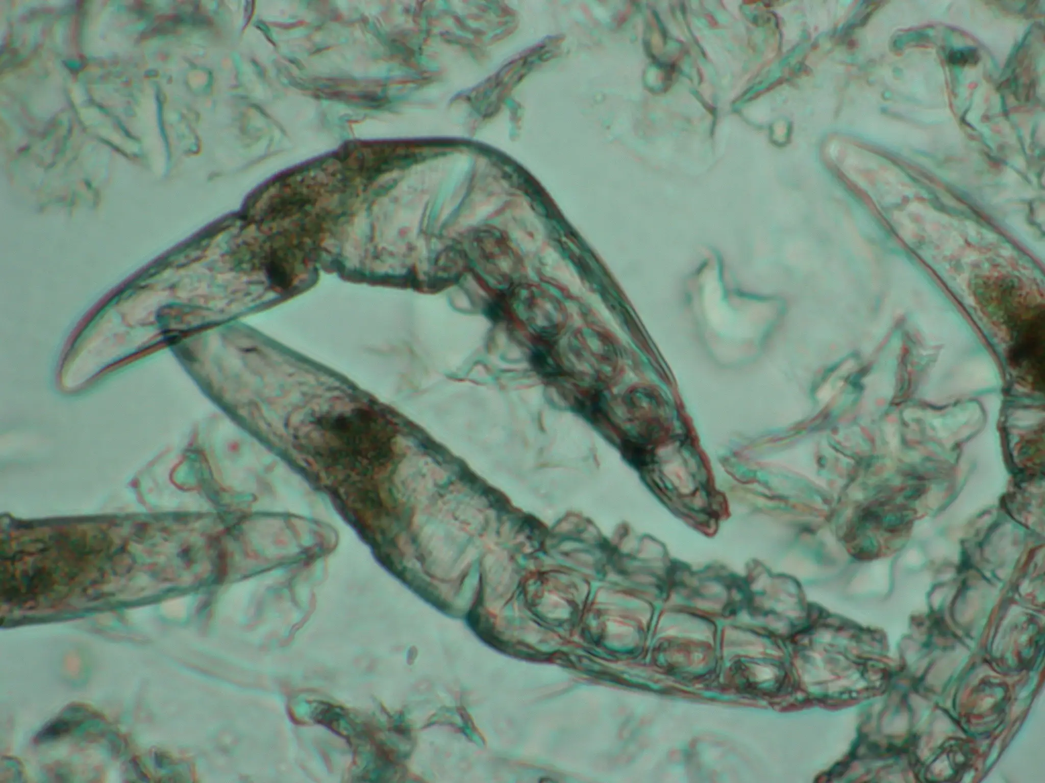 The demodex mite (Agency-Animal-Picture/Getty Images)