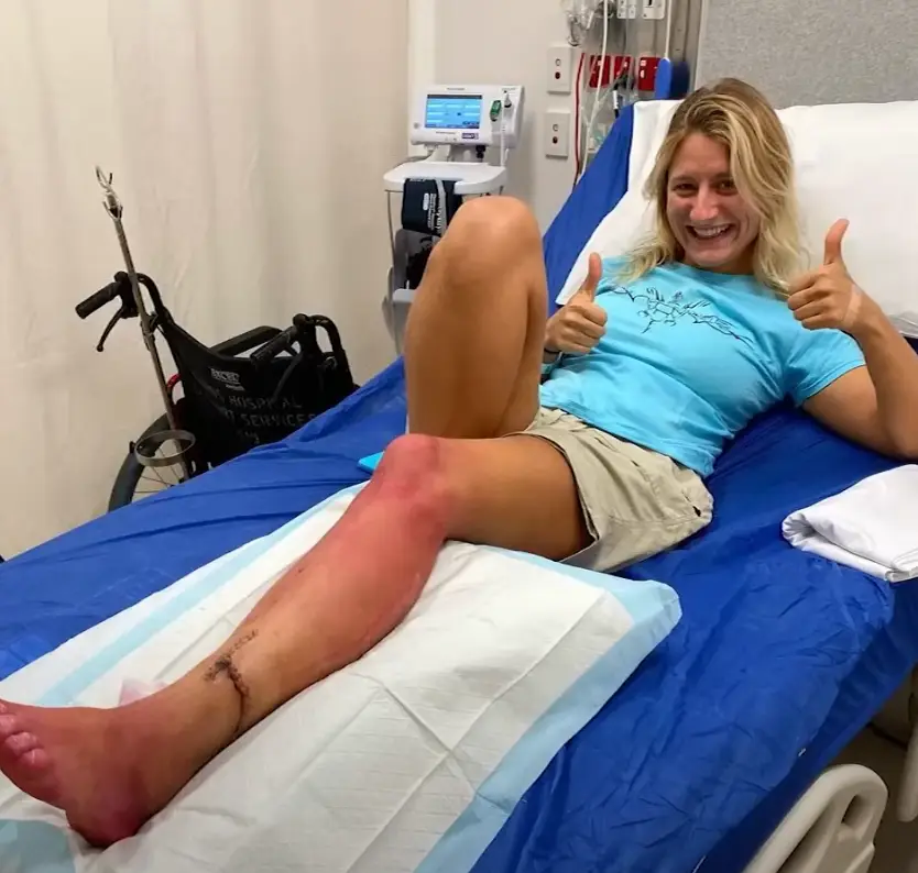 The shark severed an artery (Anika Craney/Channel 4)