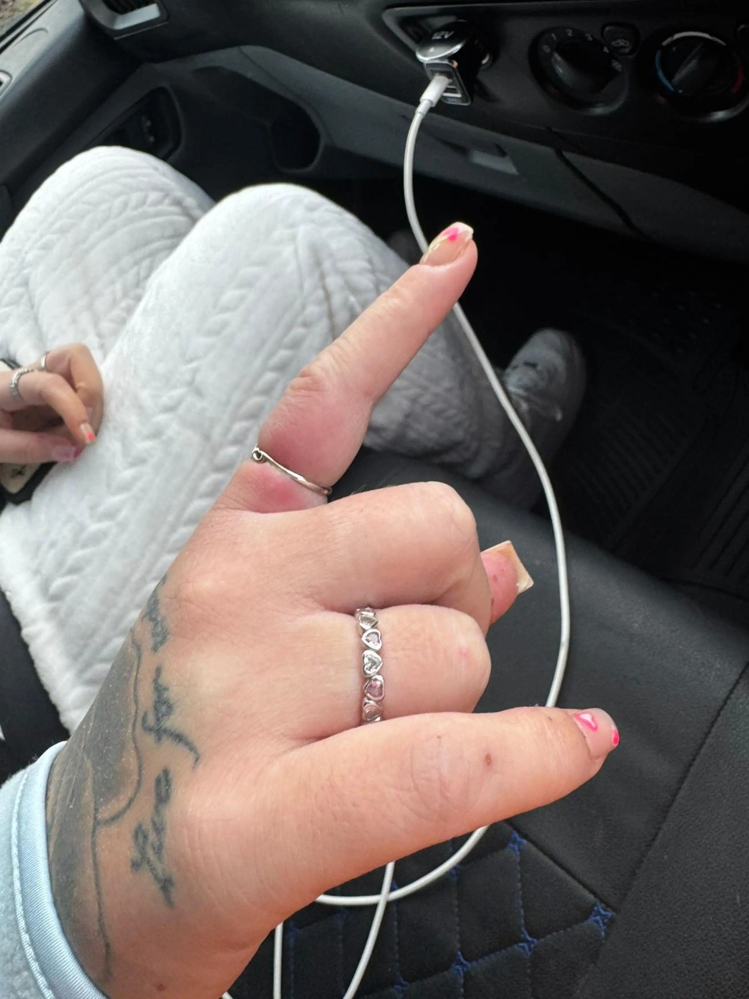 Natalia was told by doctors she was lucky to not have lost her finger, which had swollen from the burns (Kennedy News and Media)