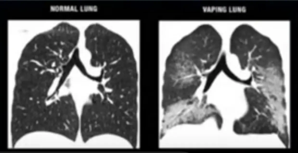 The doctor warned it was 'irreversible'  (TikTok/@sadovskaya_doctor)