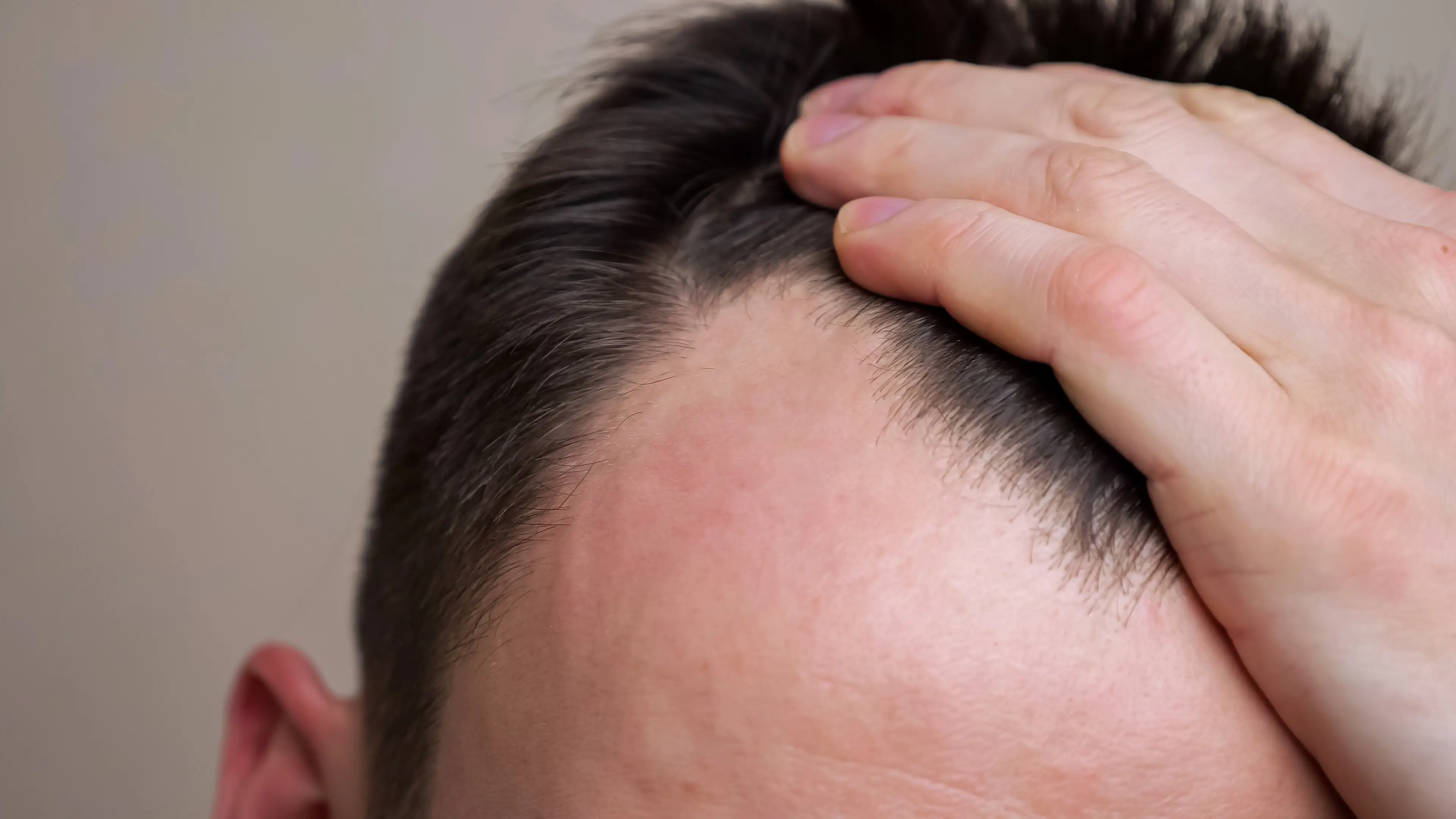 A receding hairline is for many, the first sign of losing your hair (Getty Stock Images)