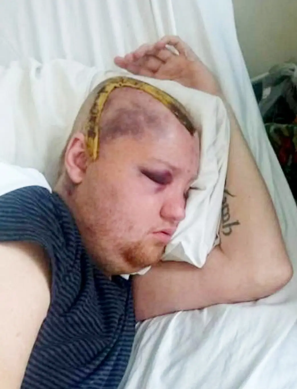 He underwent major surgery but they failed to give an MRI scan within 48 hours after (SWNS)