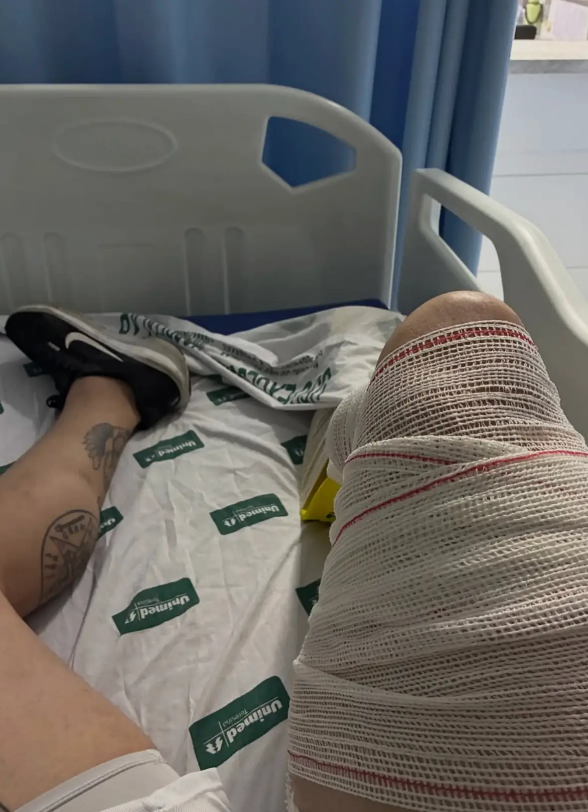 The bodybuilder ruptured his quadriceps tendon (Instagram/Ranierff)