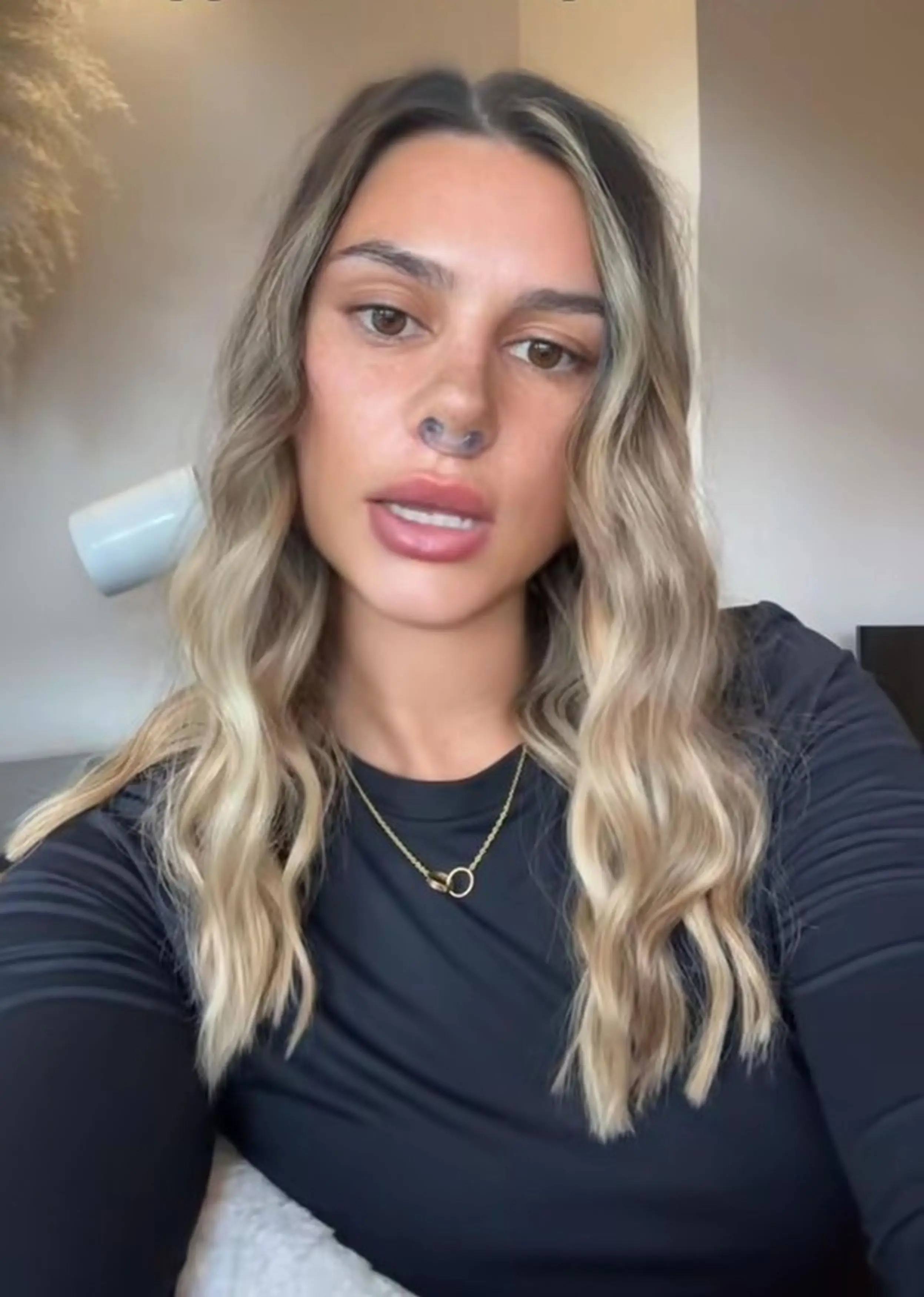 Nicole continued to take ketamine two years after her nose fell out (Kennedy News and Media)