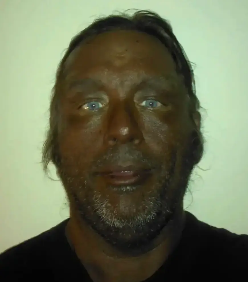 One bloke previously shared pictures showing the drastic results that taking Melanotan II had on his skin (Reddit/n3glv)
