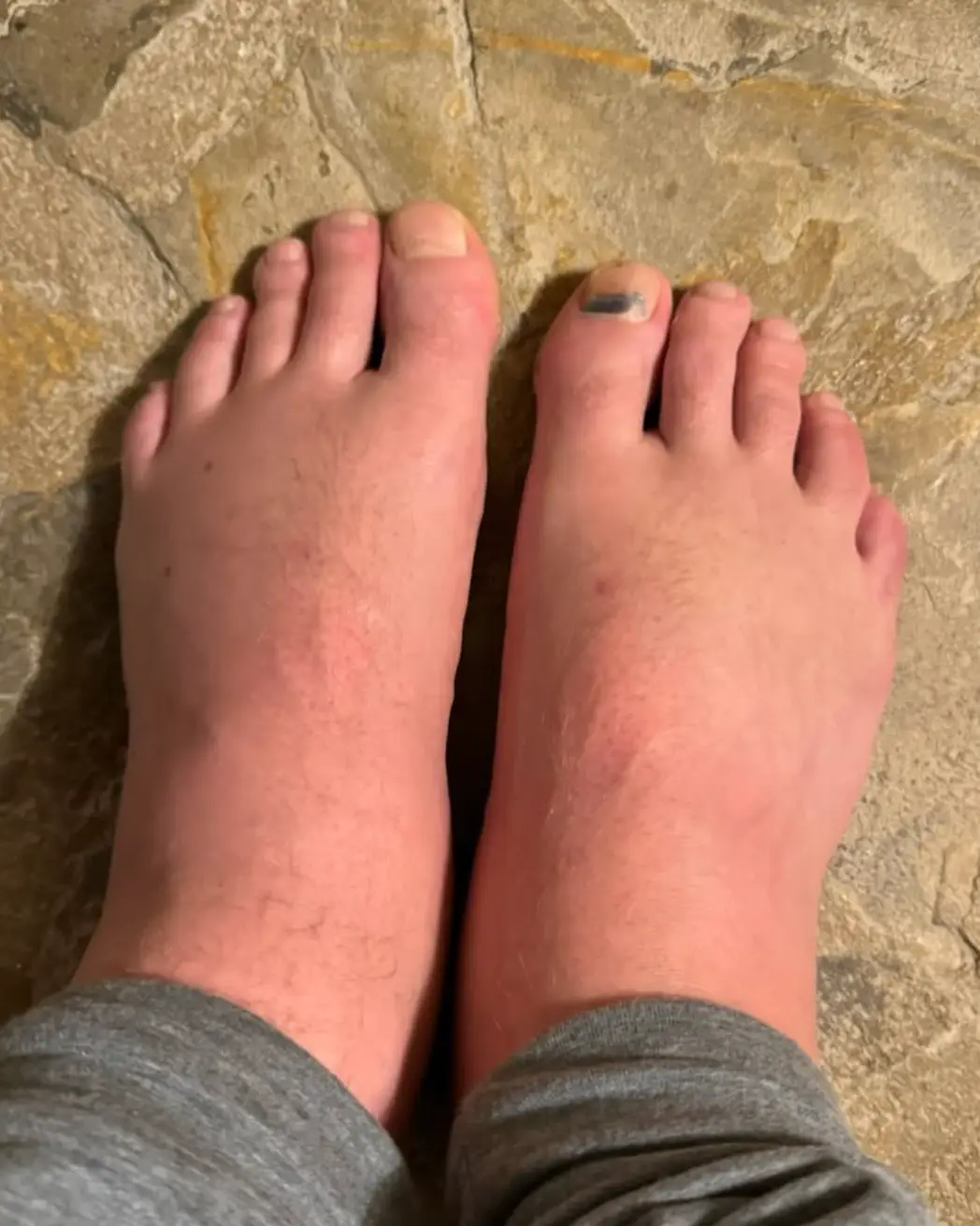 His feet have also taken a battering (Instagram/@jamielaing)