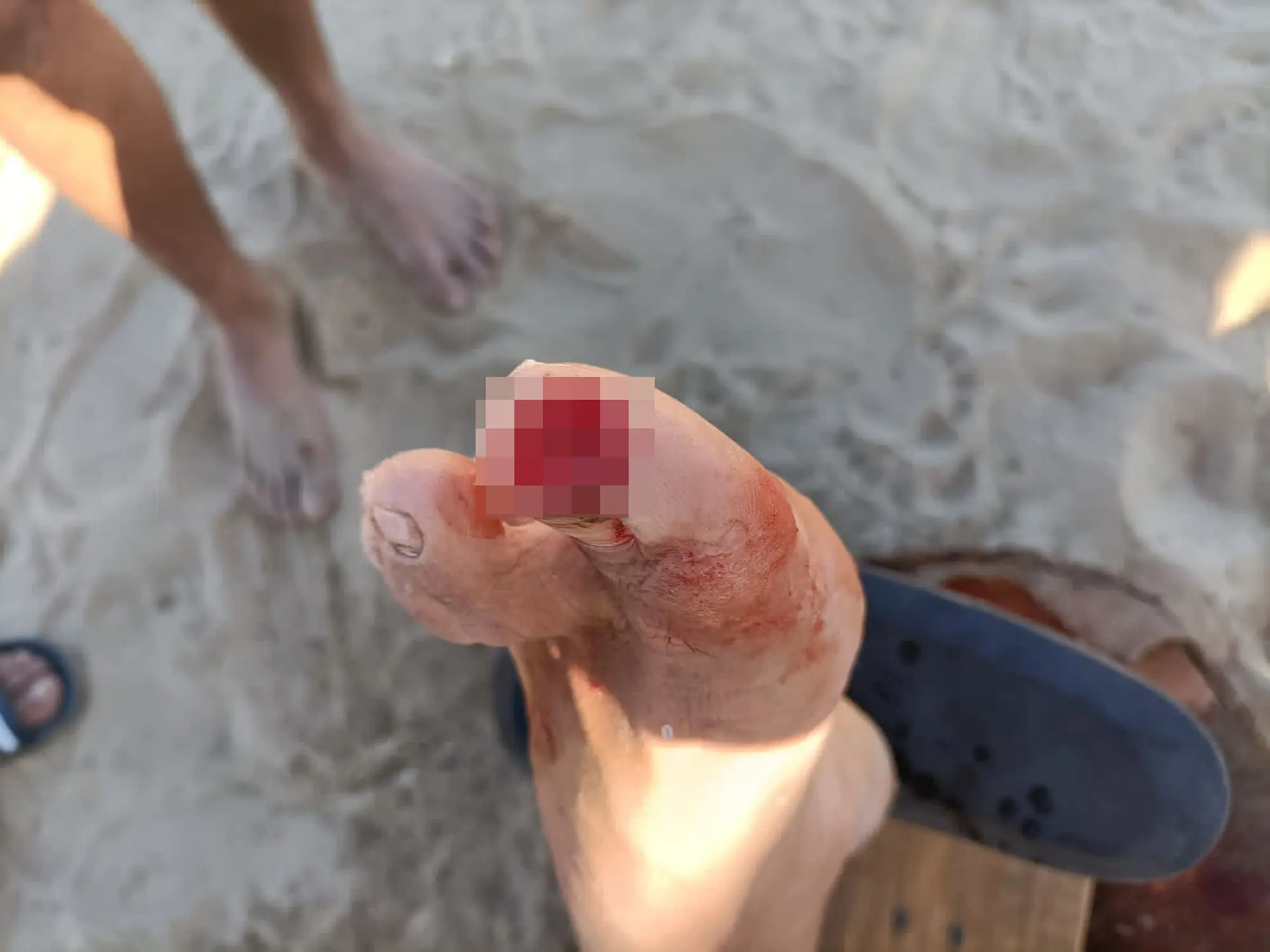 Experts have warned that the hotter weather makes piranha attacks more likely (CEN)