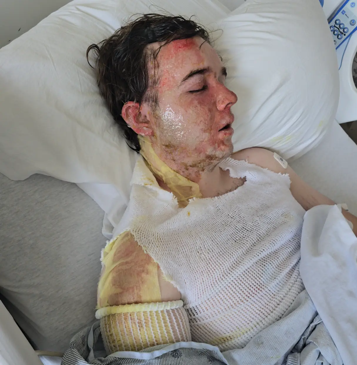 Jacob Smith was left in 'excruciating pain' after the attack (GoFundMe)