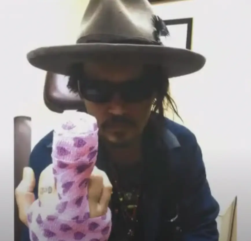 Johnny Depp showed off his injured finger.