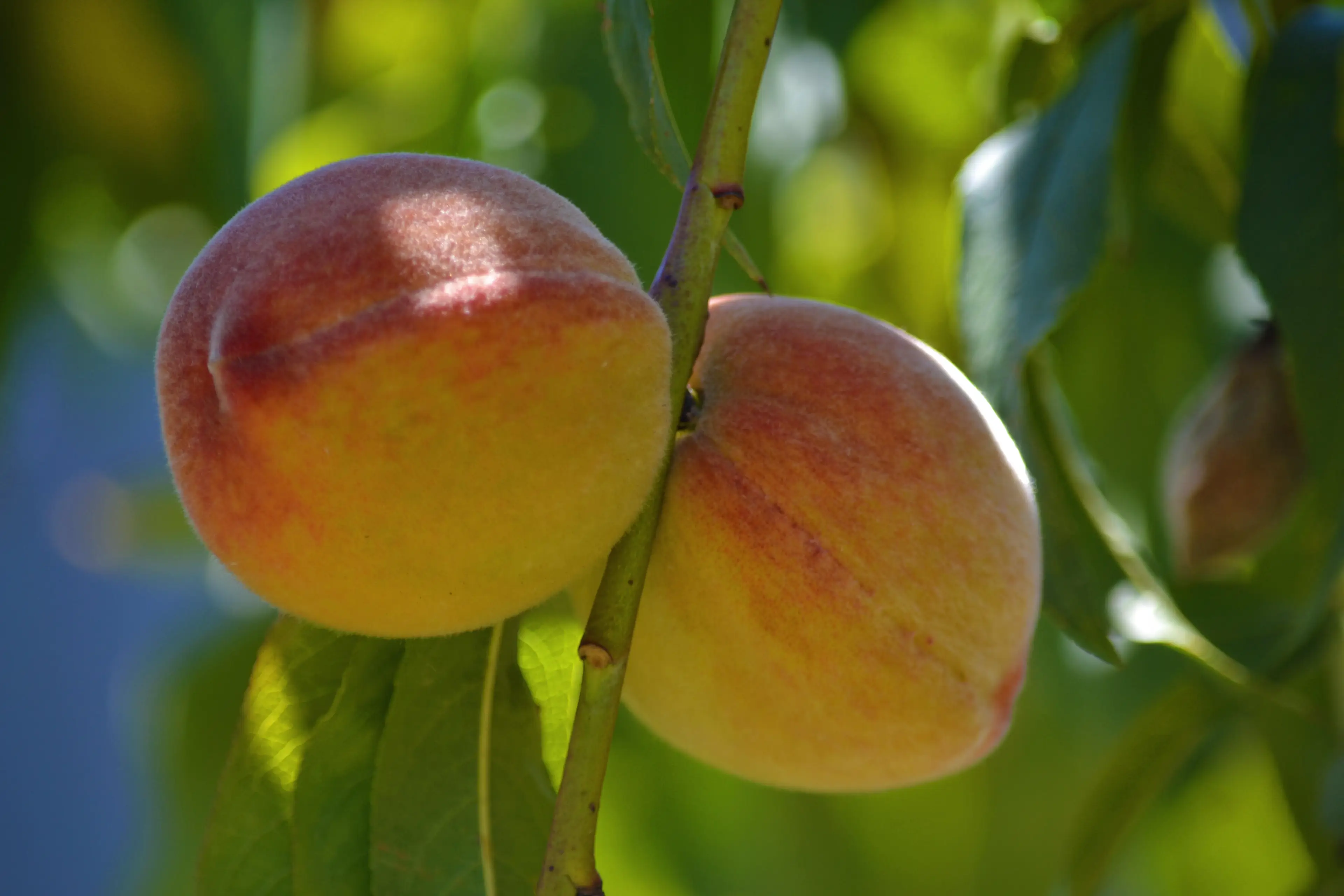 Some are opting for plastic surgery to smooth them out.