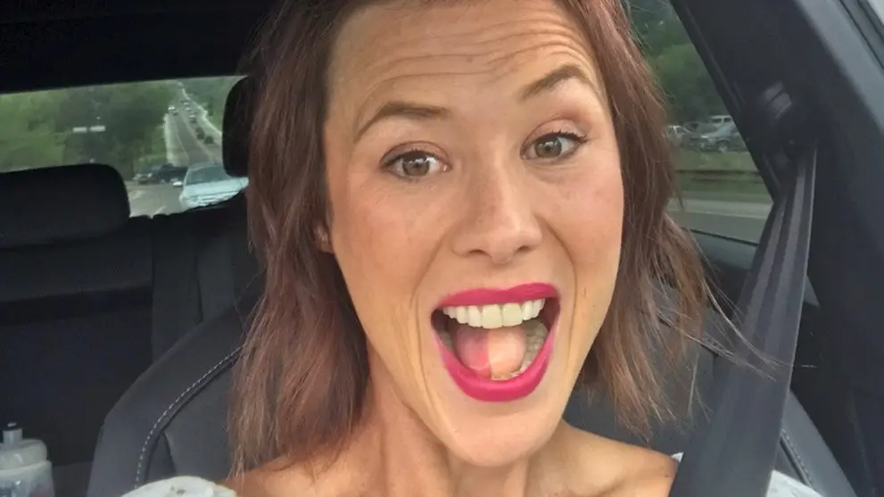 Mum Who Had Tongue Partially Replaced With Leg Tissue Says It 'Started Growing Hair'