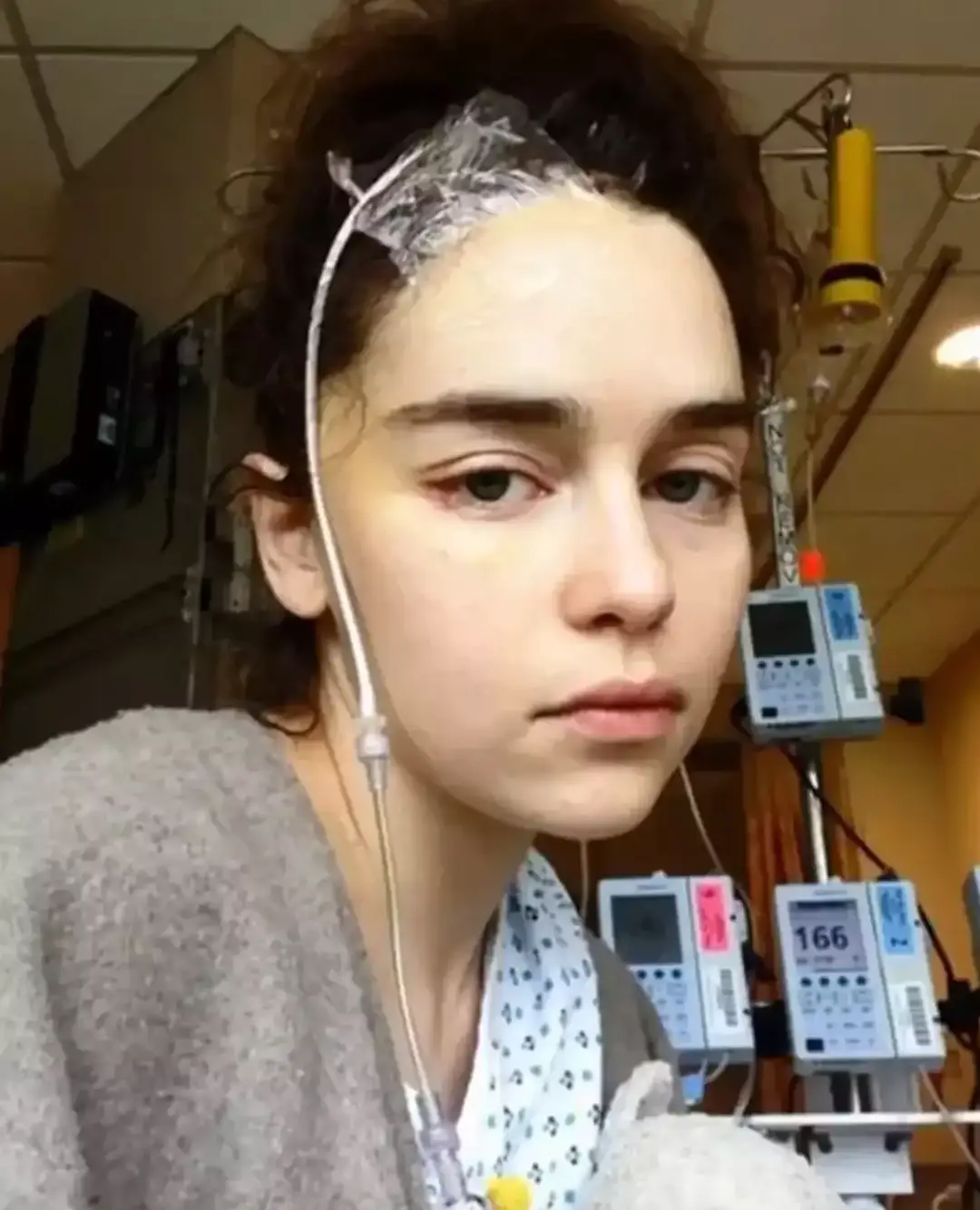 Clarke had to undergo two serious surgeries in two years. (CBS)