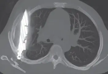 It's a yikes from me (National Library of Medicine)