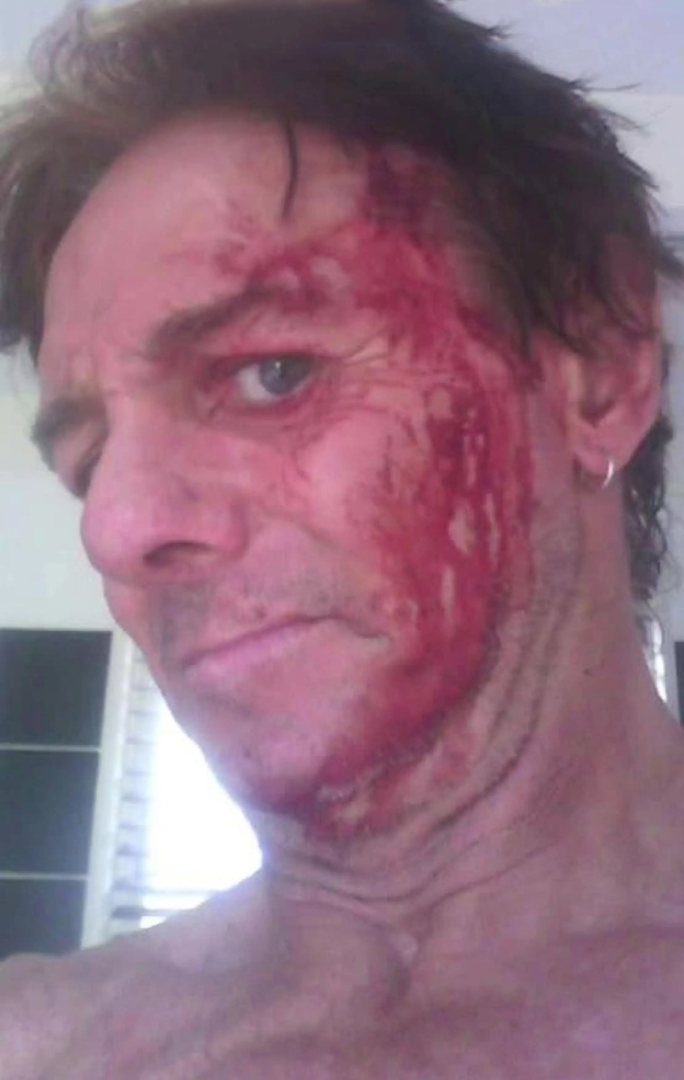 Adrian Stock had a run-in with a monster kangaroo seven years ago (Kennedy News and Media)