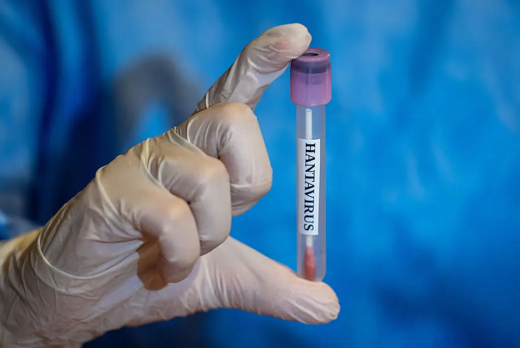 A cruise ship outbreak of hantavirus is currently being monitored (Arman Onal/Anadolu via Getty Images)
