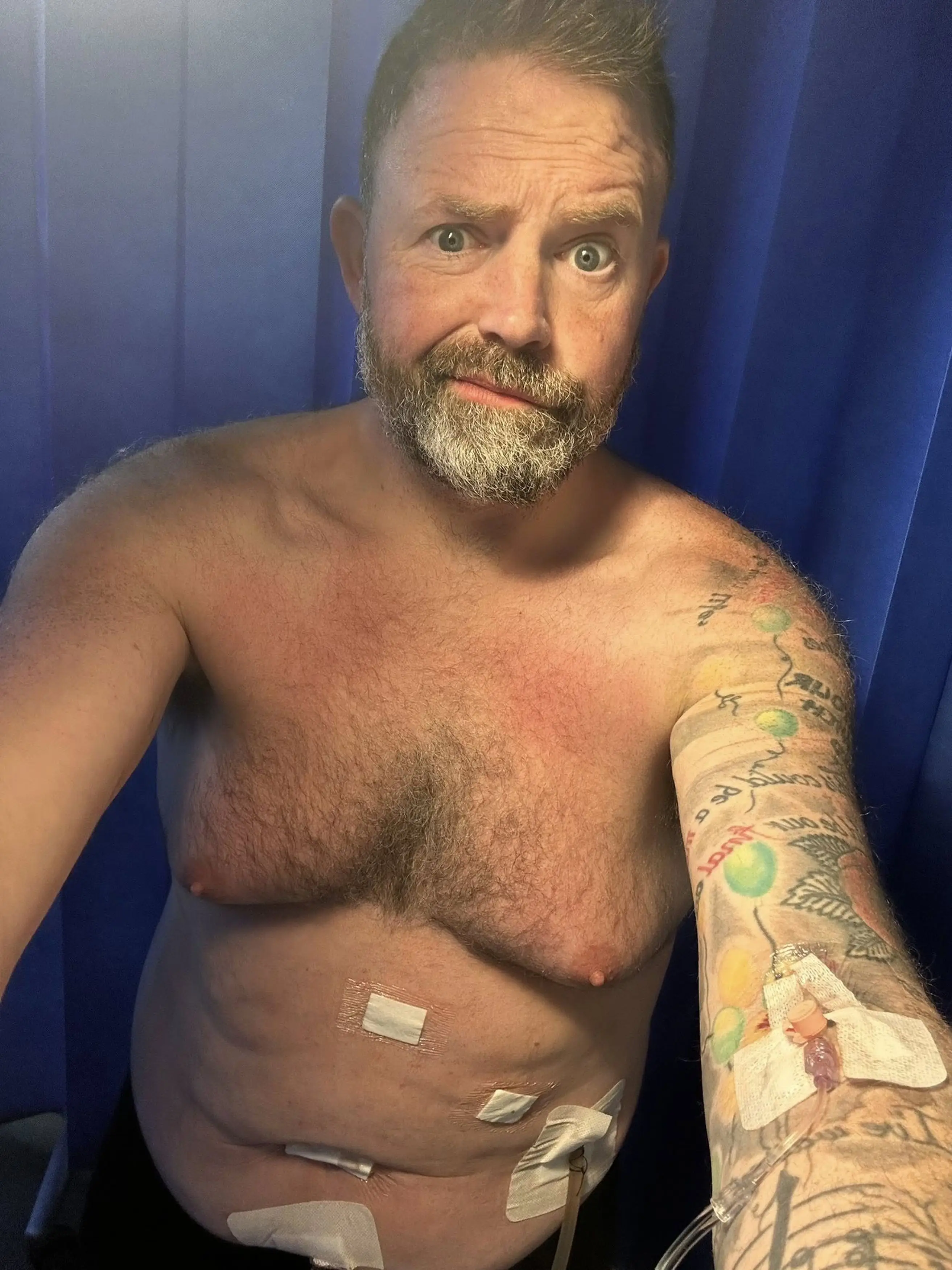 Edd was diagnosed with the life-threatening condition gangrenous cholecystitis and had to go in for surgery (Kennedy News and Media)
