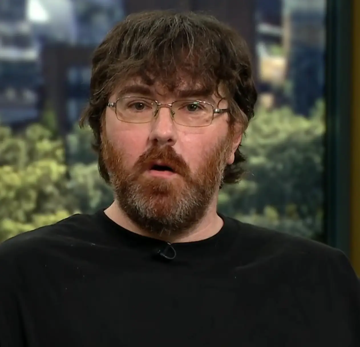 Michael was diagnosed with a micropenis (ITV)