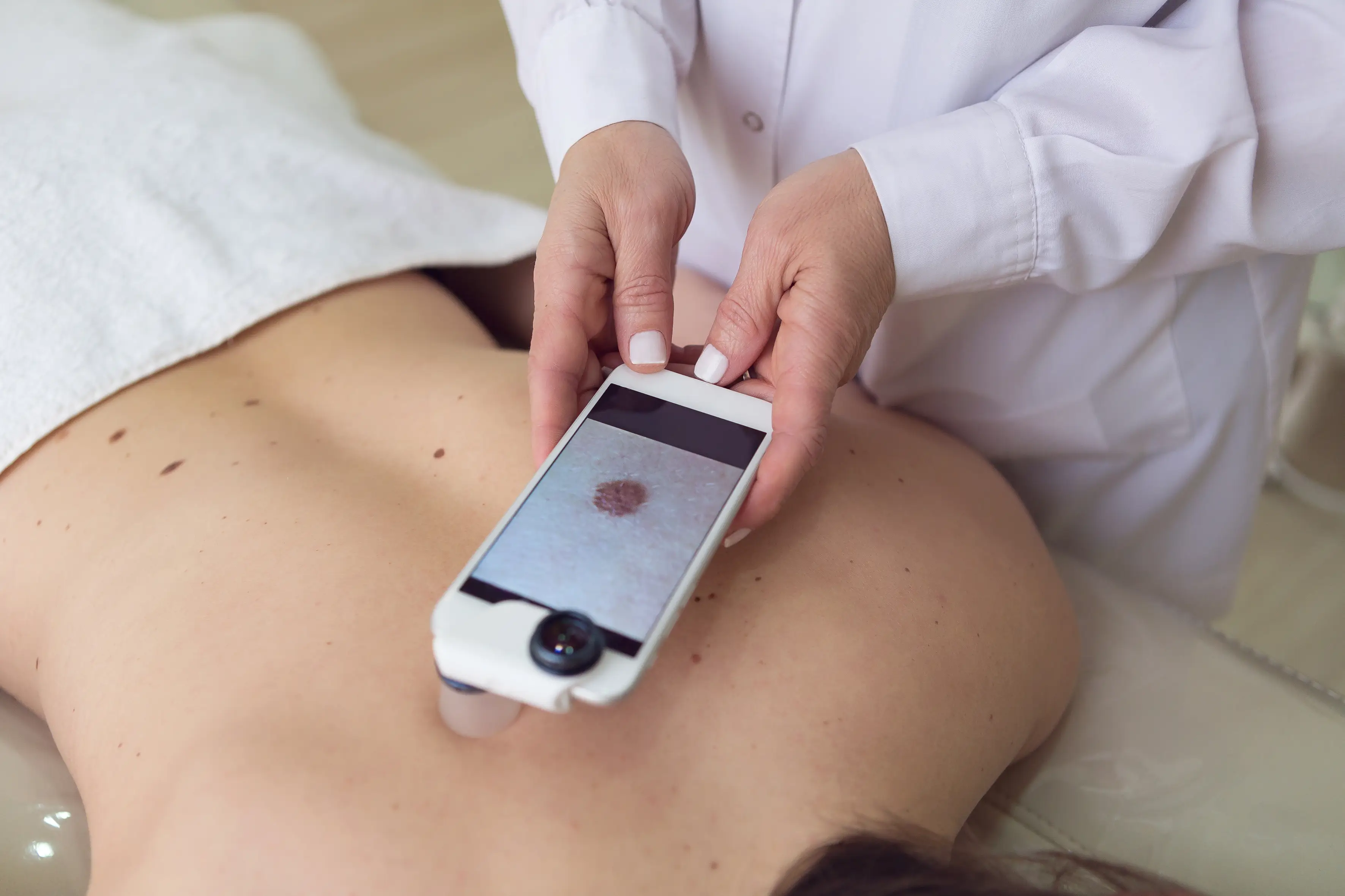 The majority of skin cancer cases are basal cell carcinoma, squamous cell carcinoma or malignant melanoma (Getty Stock Images)