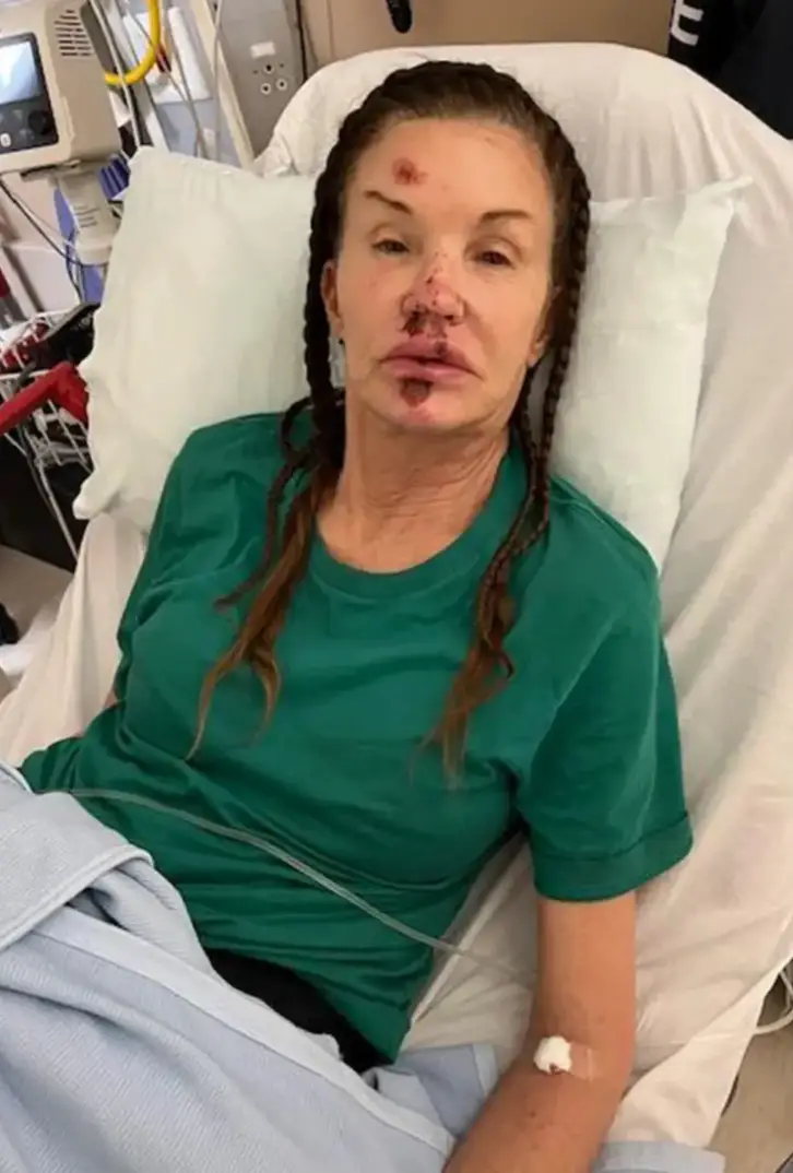 The 2023 I'm A Celeb: All Stars contestant wants remuneration for her injuries (Janice Dickinson)