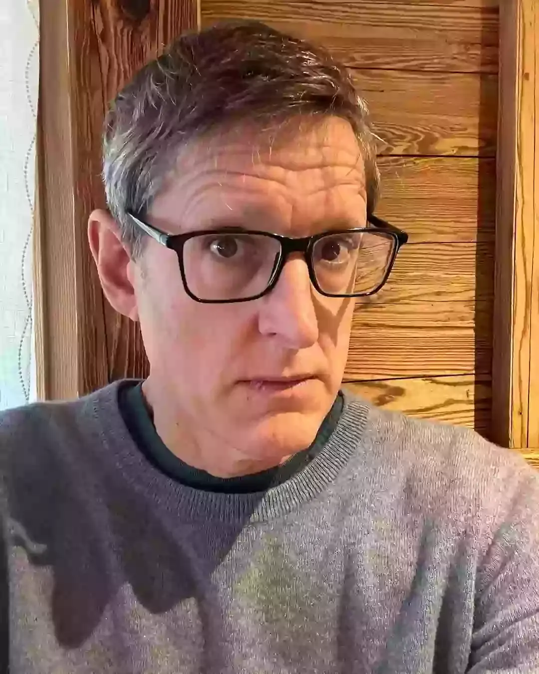 The TV star has been candid about his alopecia over the years (Instagram/@officiallouistheroux)