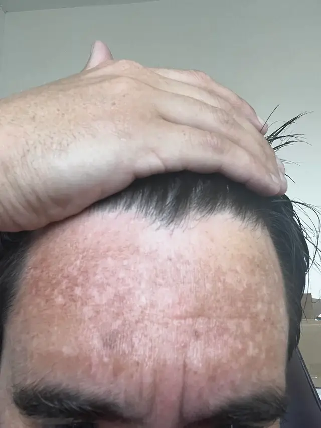 He shared his skin situation on Reddit.