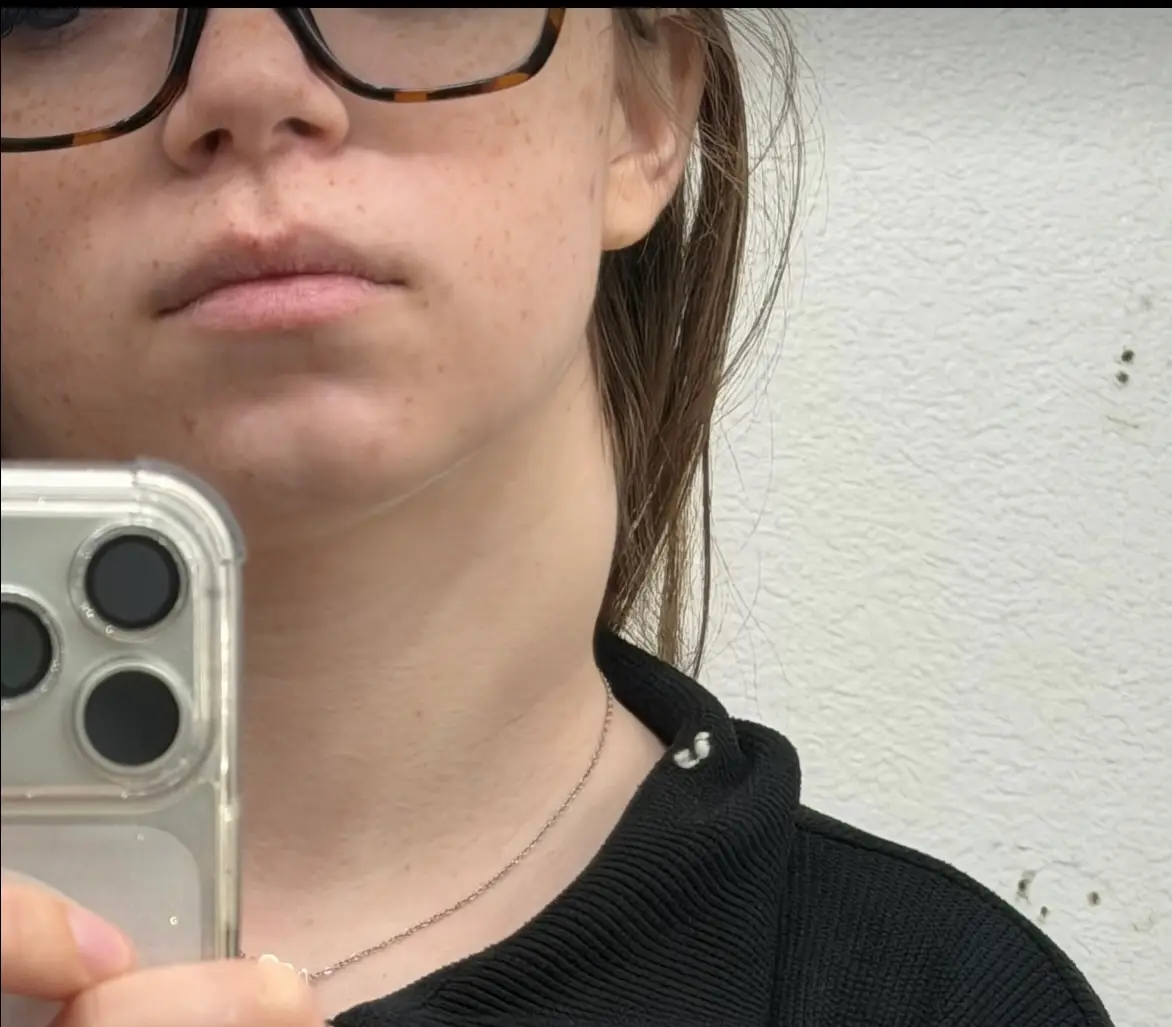 She developed a huge lump in her neck while also dealing with ear issues (TikTok/@moody.aidaa)