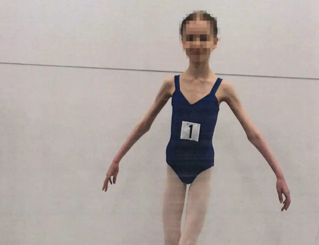Her ballet teachers alerted authorities after becoming concerned that she was malnourished (District Court of Western Australia)