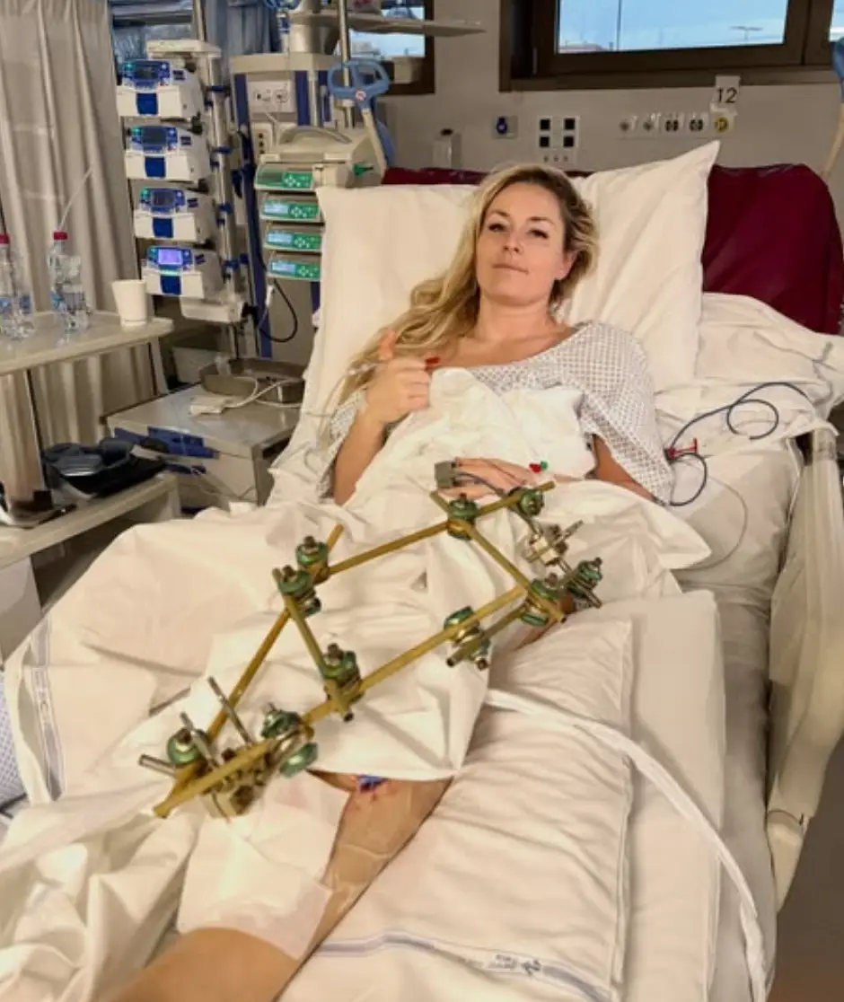 The 41-year-old has since said she has no regrets about taking part in the race (Instagram/Lindsey Vonn)