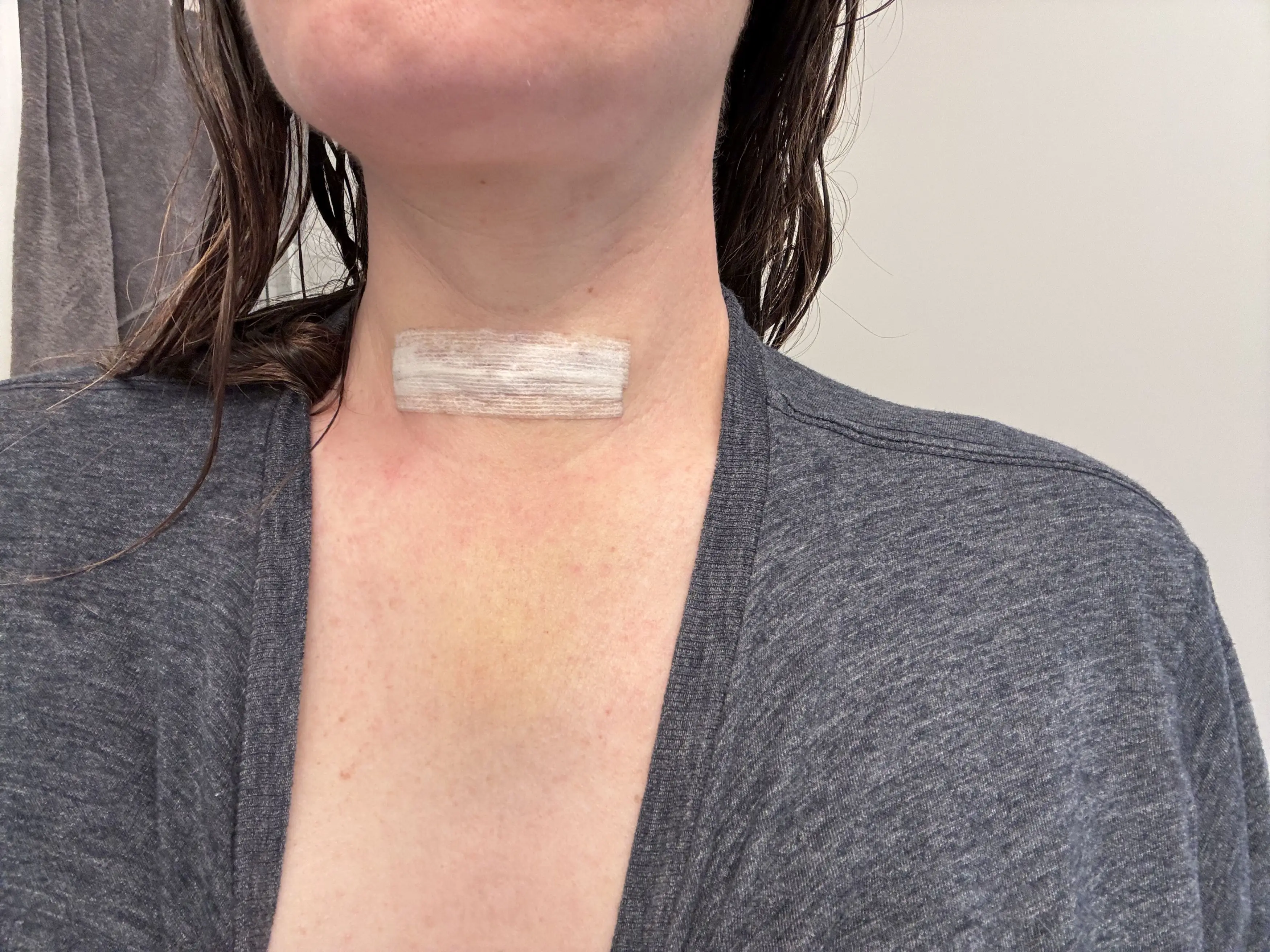 Two lymph nodes were found in her neck (Kennedy News and Media)