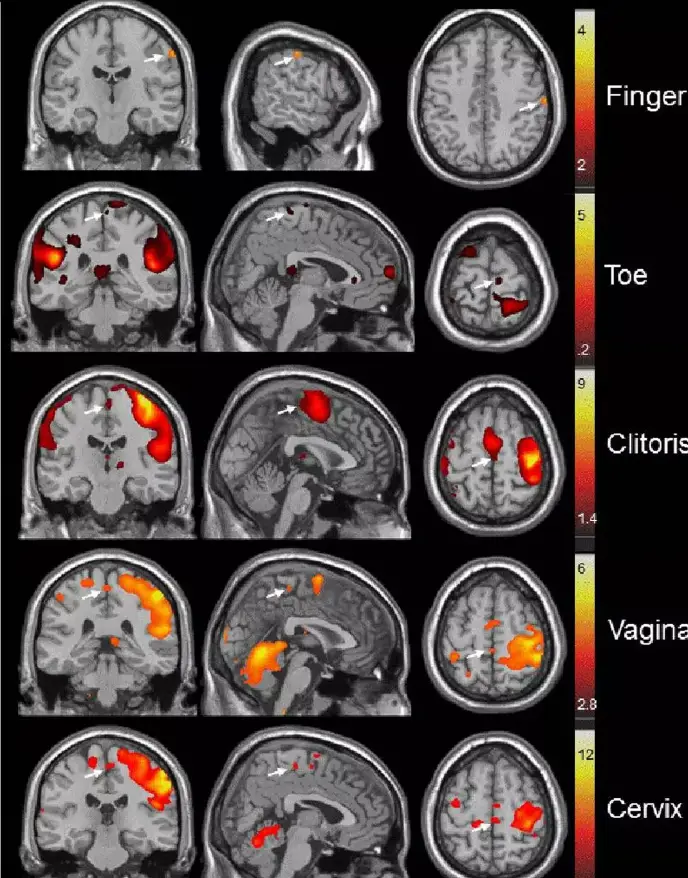 Different parts of the brain are stimulated by pleasure (Komisaruk et al 2011)