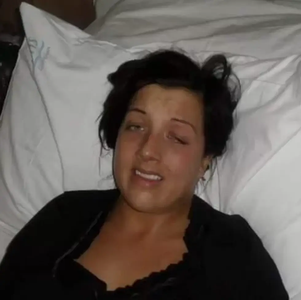 Sutherland originally went under the knife to relieve her migraines.