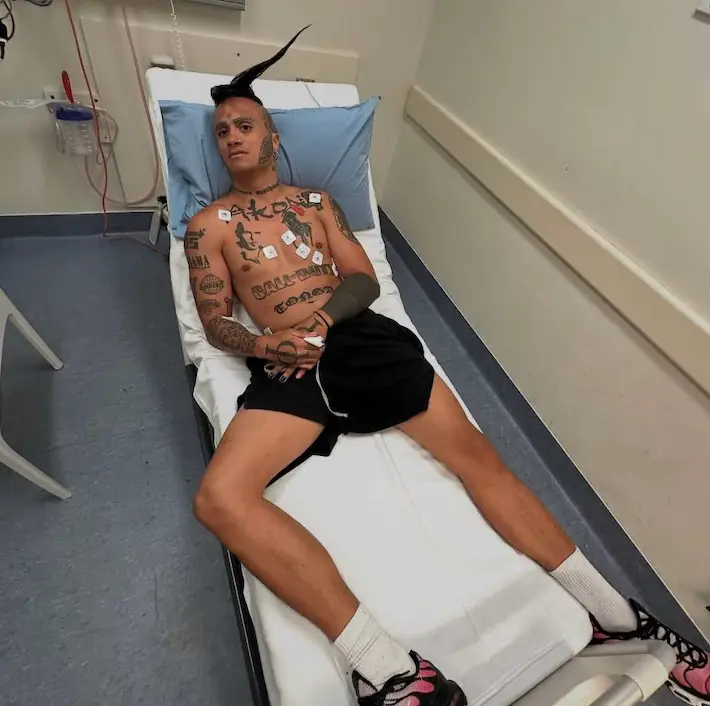 The influencer later shared a pic from hospital (Instagram/@lilgolo)