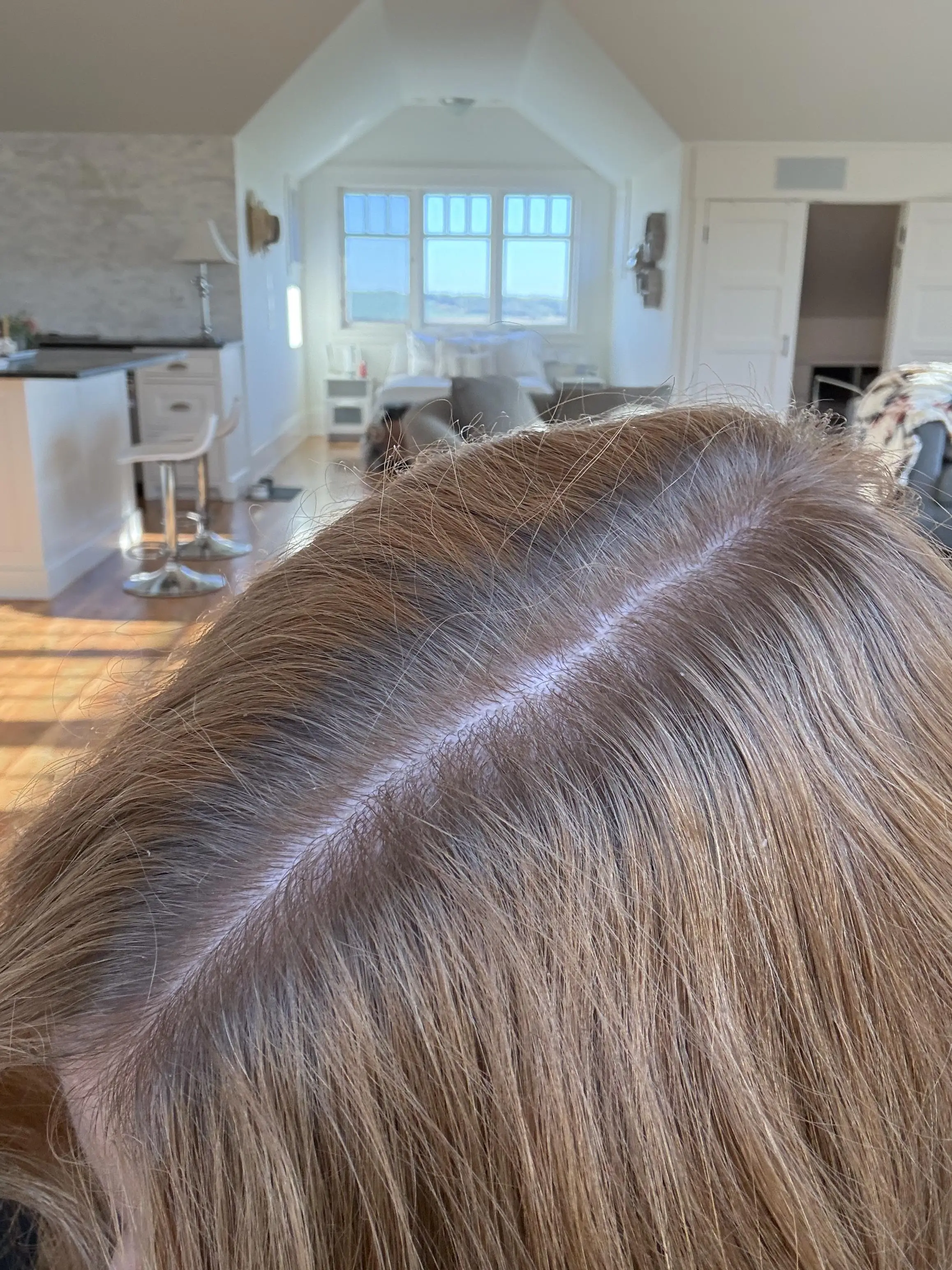 One Reddit user's copper hair started to take on a blackness after Melanotan II entered her system (Reddit/Temporary-Peanut6707)