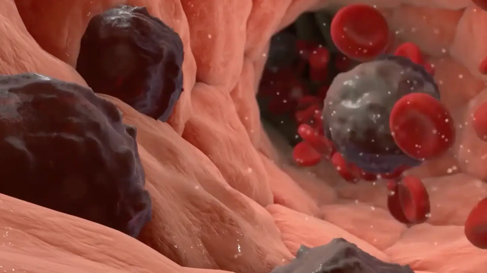 Rocky Mountain Cancer Centers/YouTube