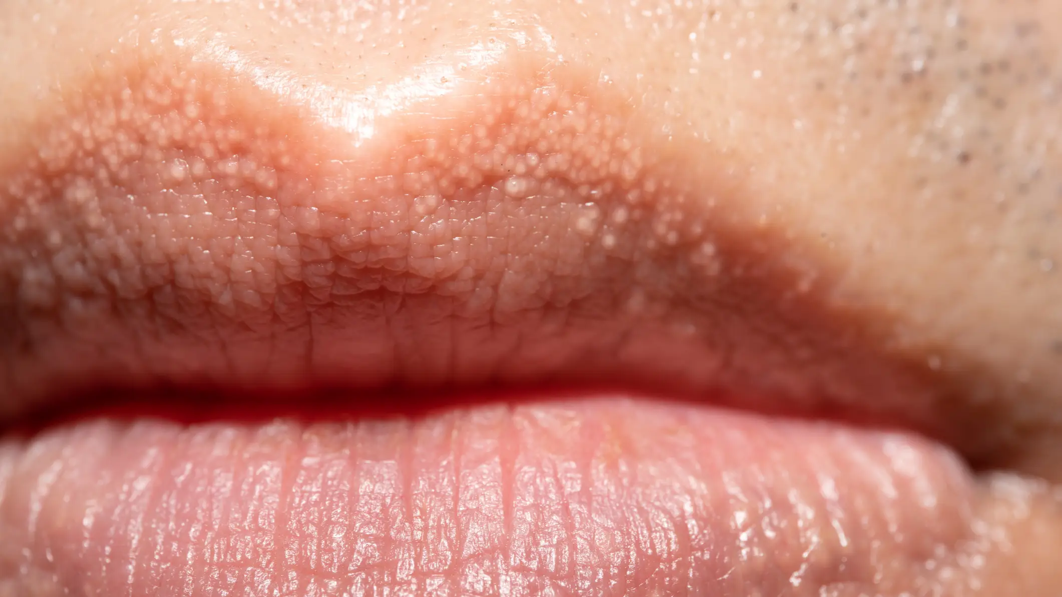 Reason behind strange white bumps you can find on your private parts