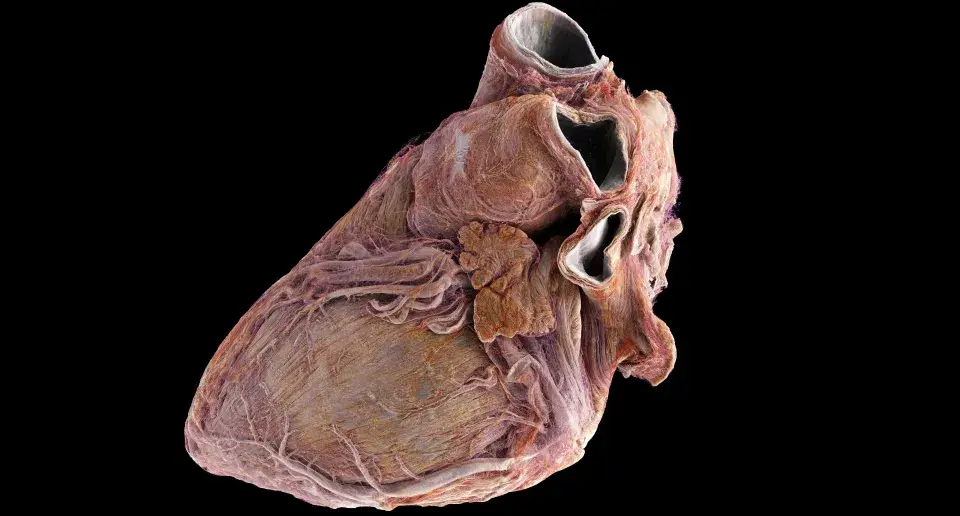 They got a good look at a healthy heart. (UCL/ESRF)