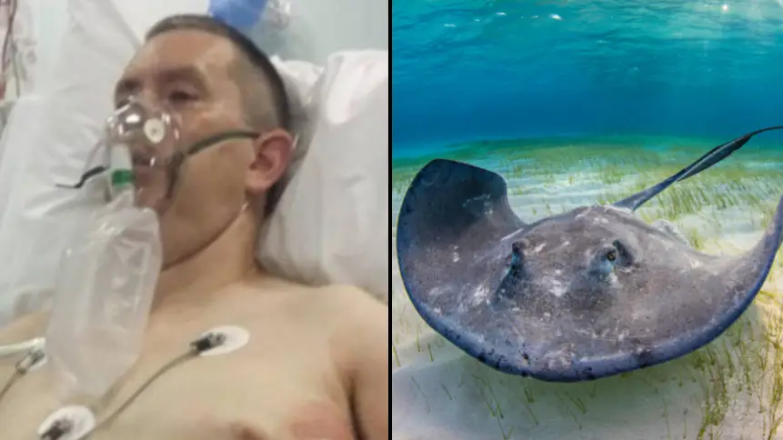 Man Who Almost Died From Stingray Attack Says It's A Good Story For The Pub