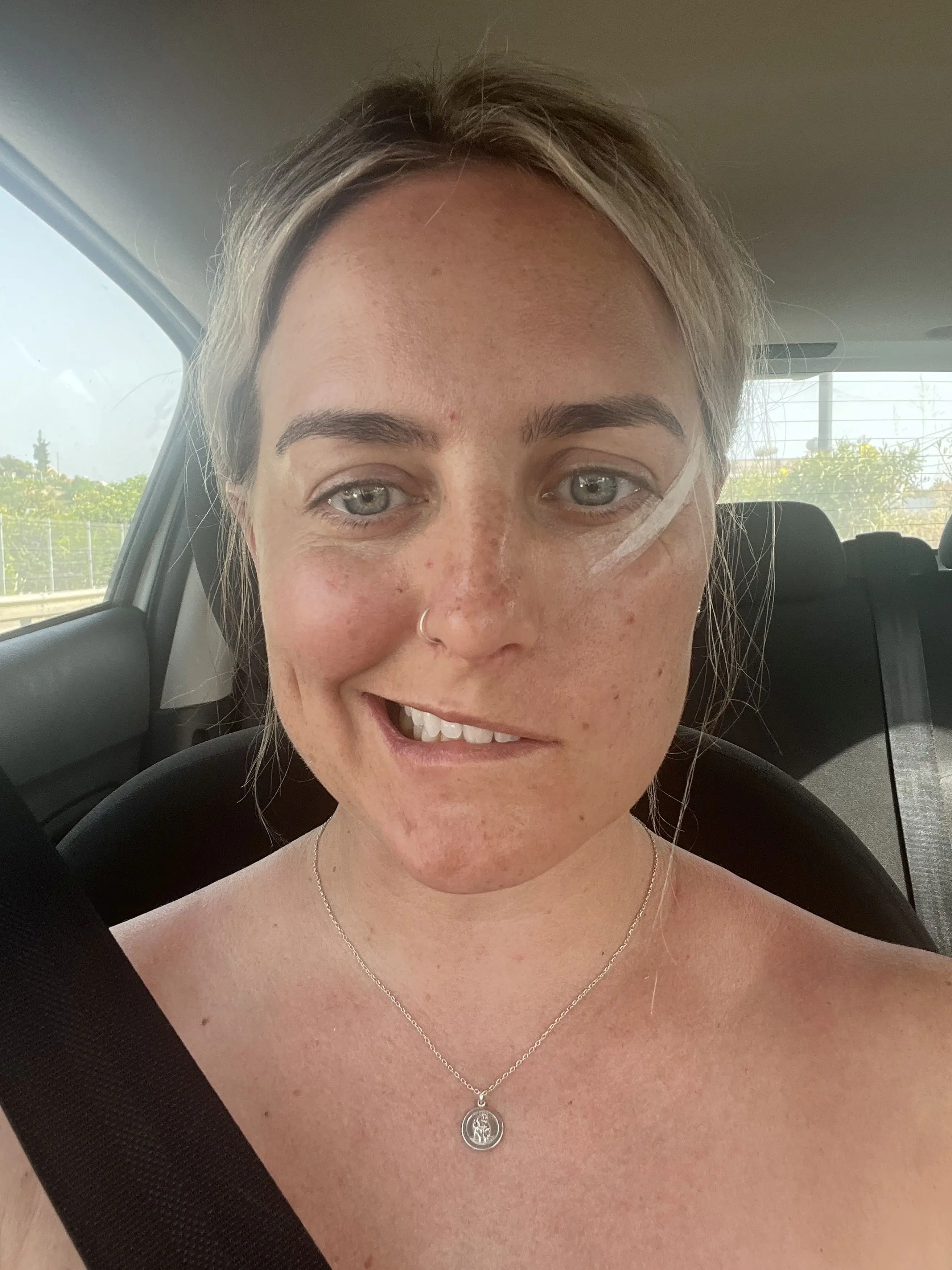 Emma was told that the condition was, in part, caused by stress (Kennedy News and Media)