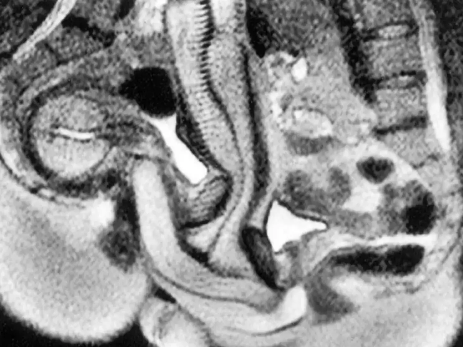 The study found that during intercourse, the woman's bladder would rapidly fill up (BMJ)