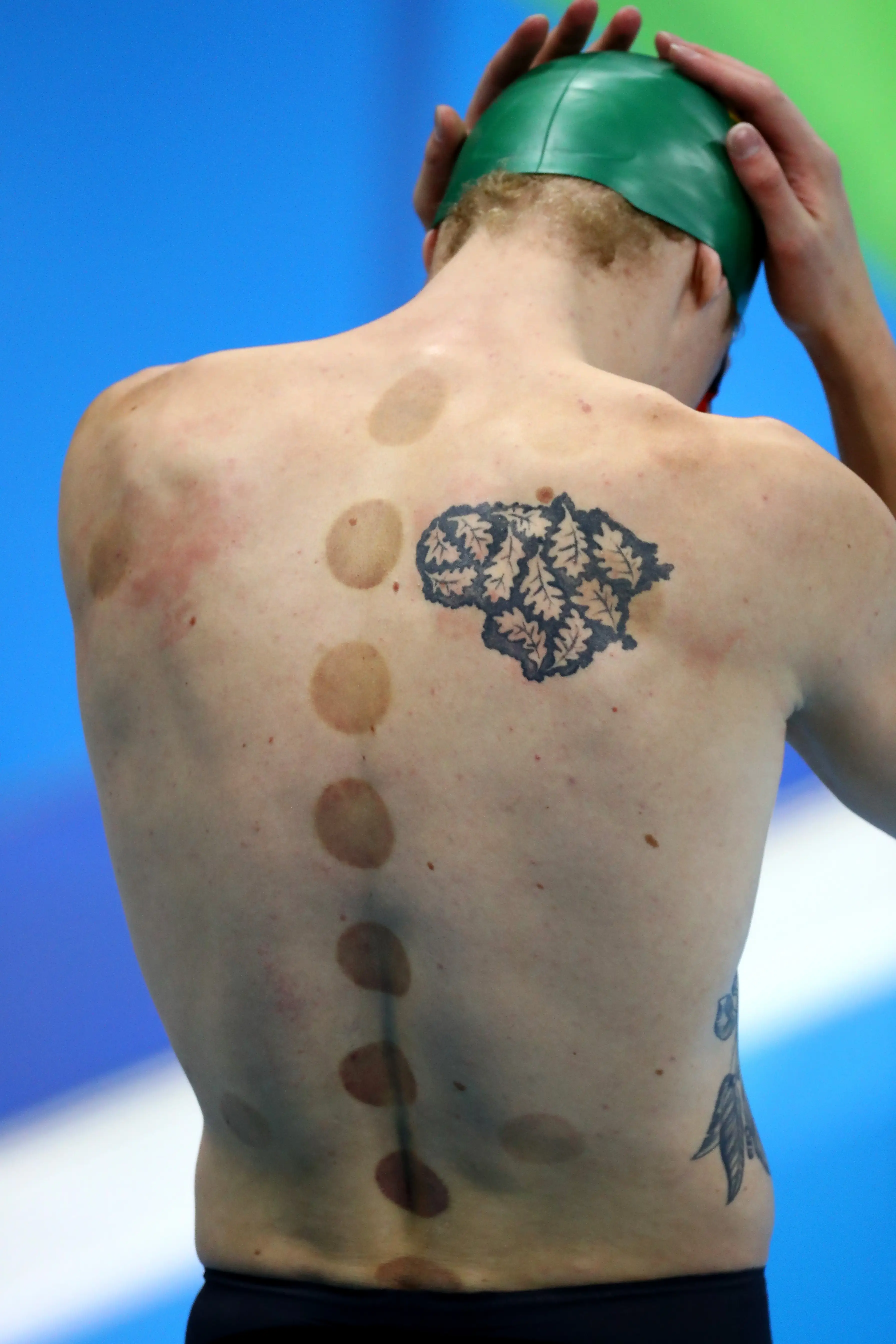 You'll see cupping like this at the 2024 Paris Olympics. (Dean Mouhtaropoulos/Getty Images)