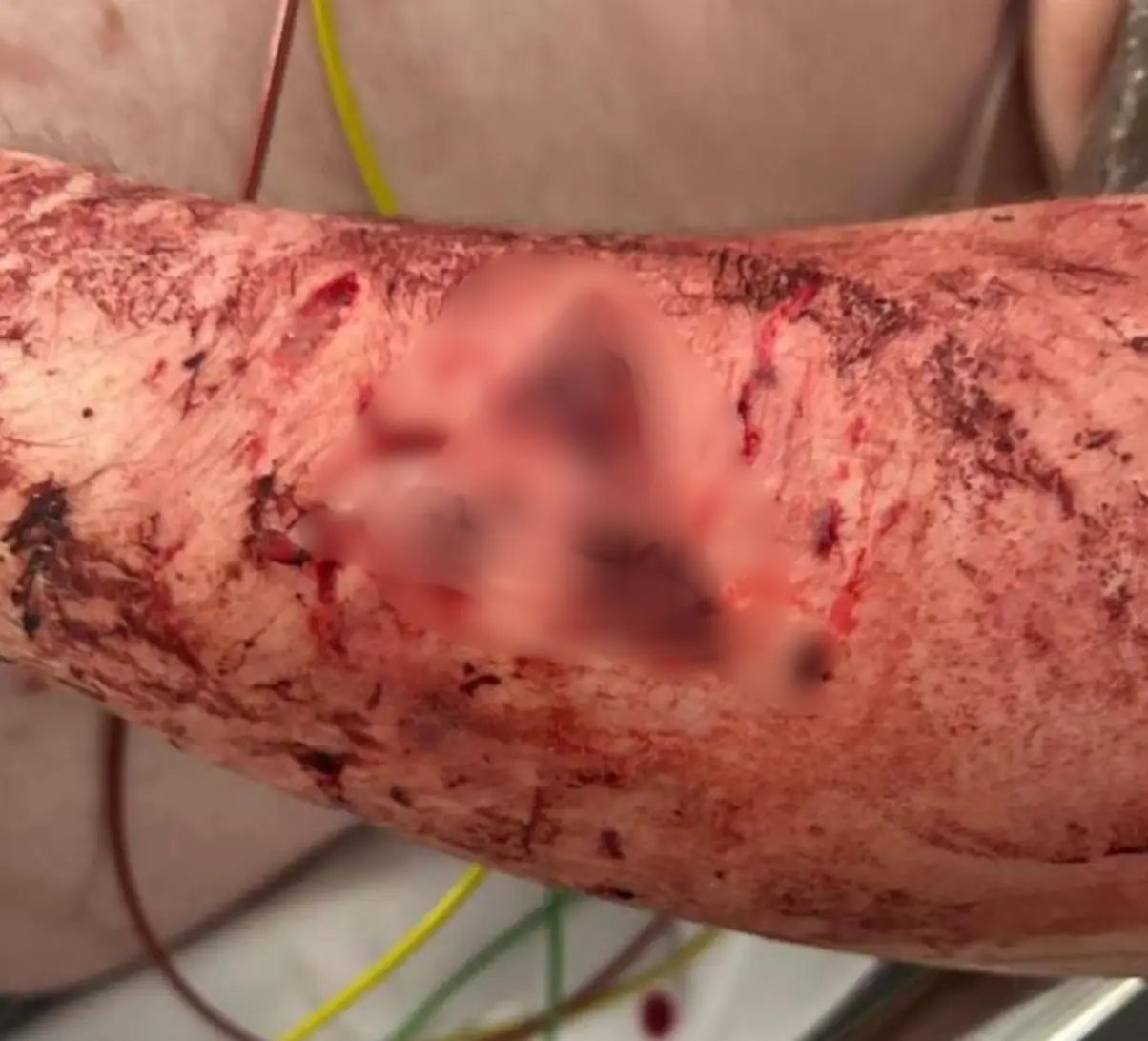 Ending up in hospital, he's been credited with saving their lives (JustGiving)