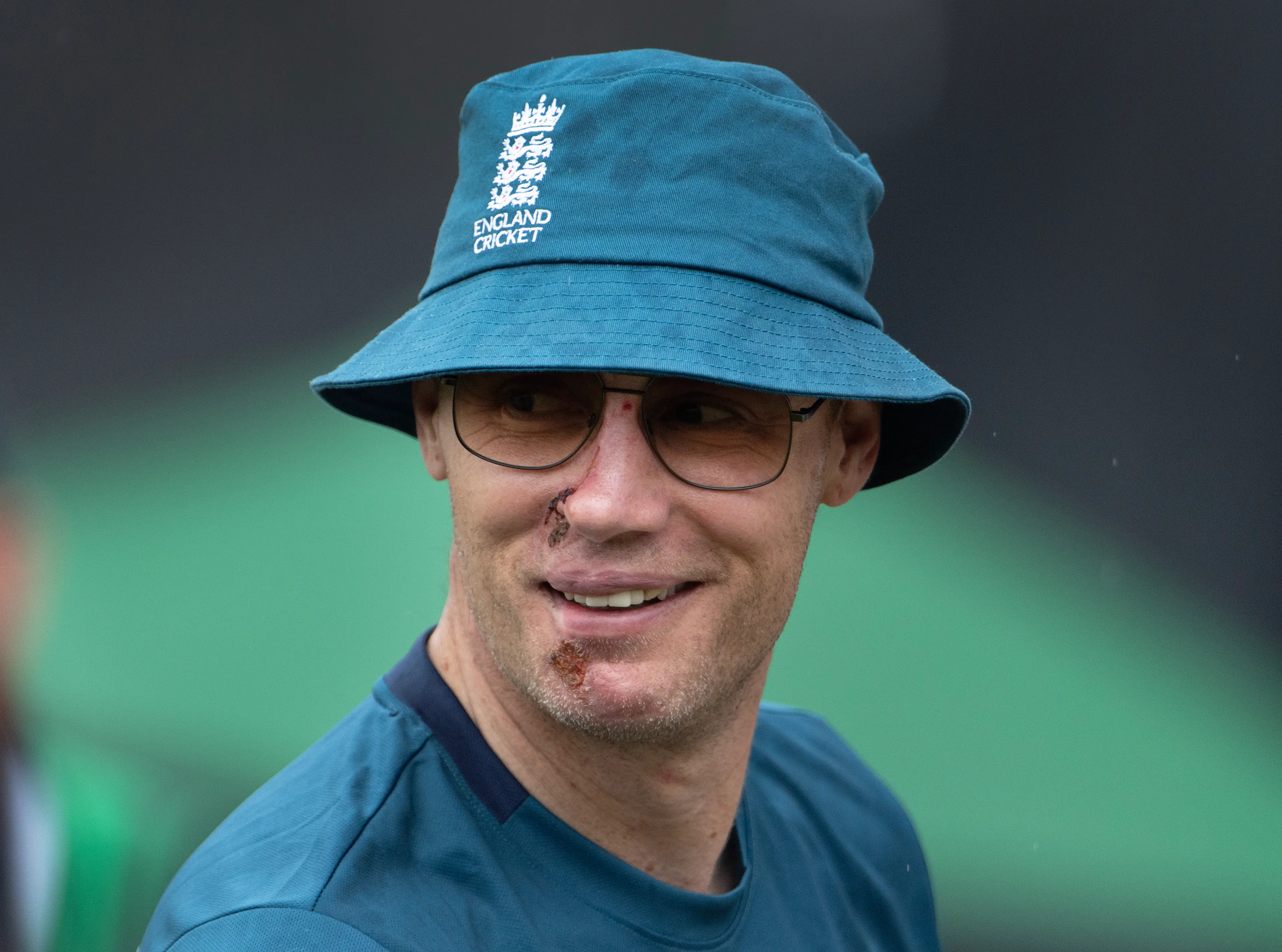 A friend claims he has 'mellowed' since his Top Gear filming accident.