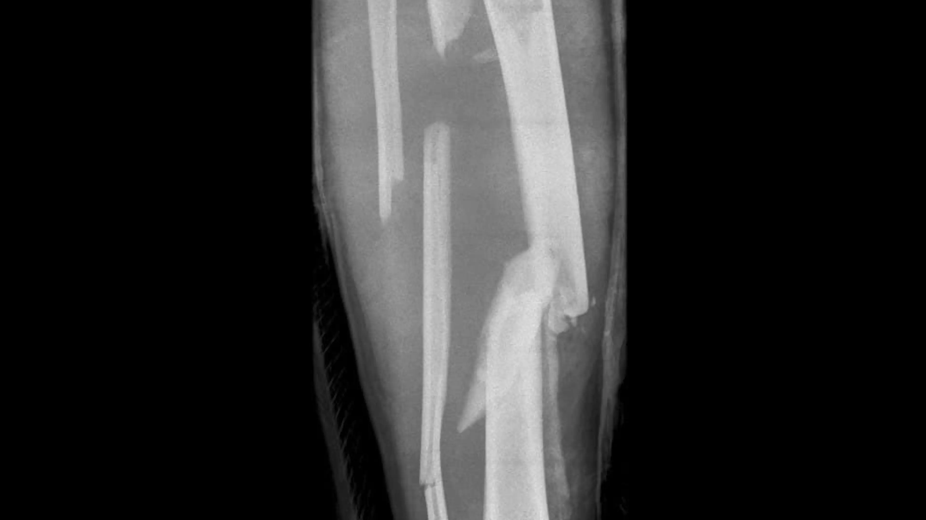 (Getty Stock Images)