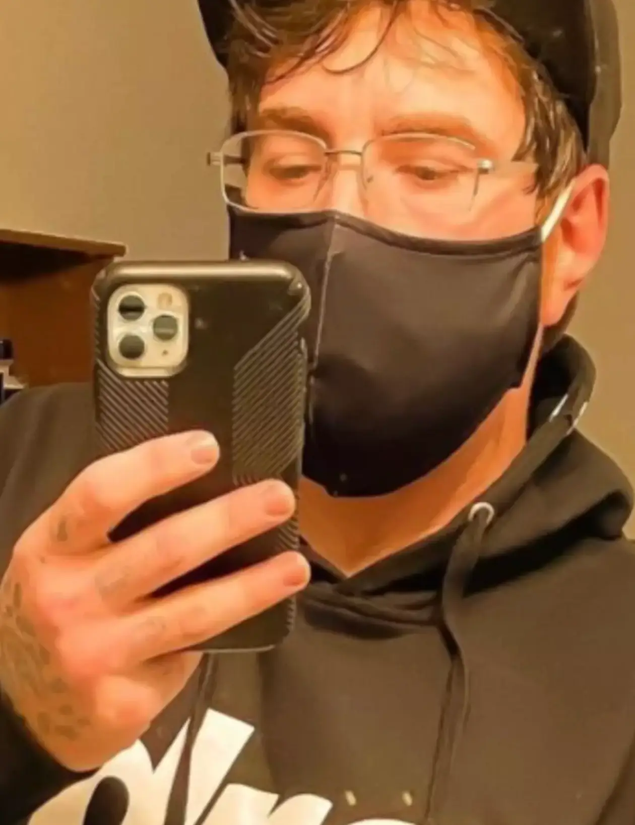 Michael has been open about his 'micropenis' condition (Instagram/whutzhisphaze)