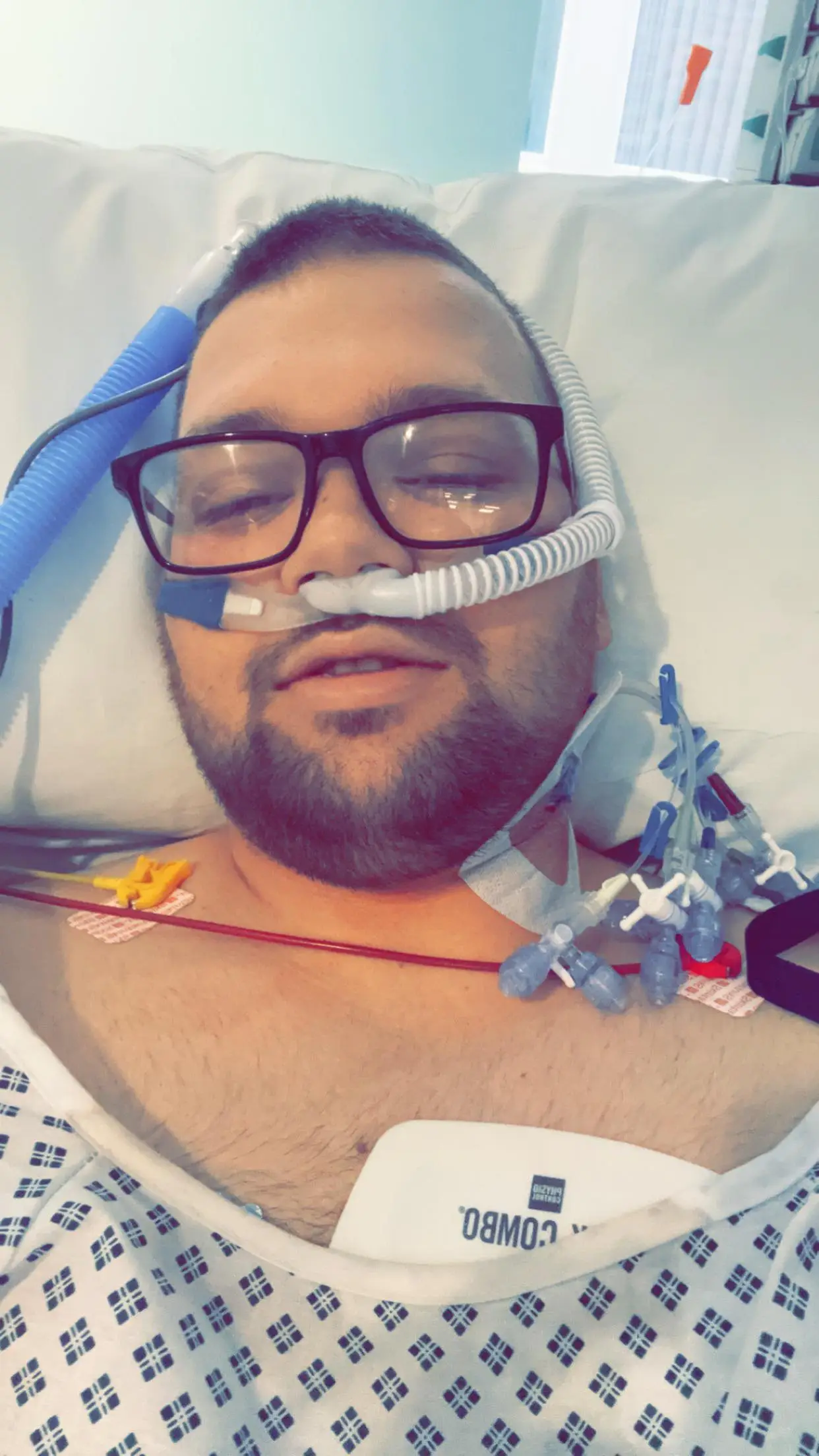 He now only has one functioning lung.  (SWNS)