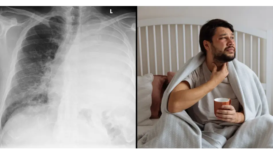 Credit: Radiopedia/Getty Stock Images