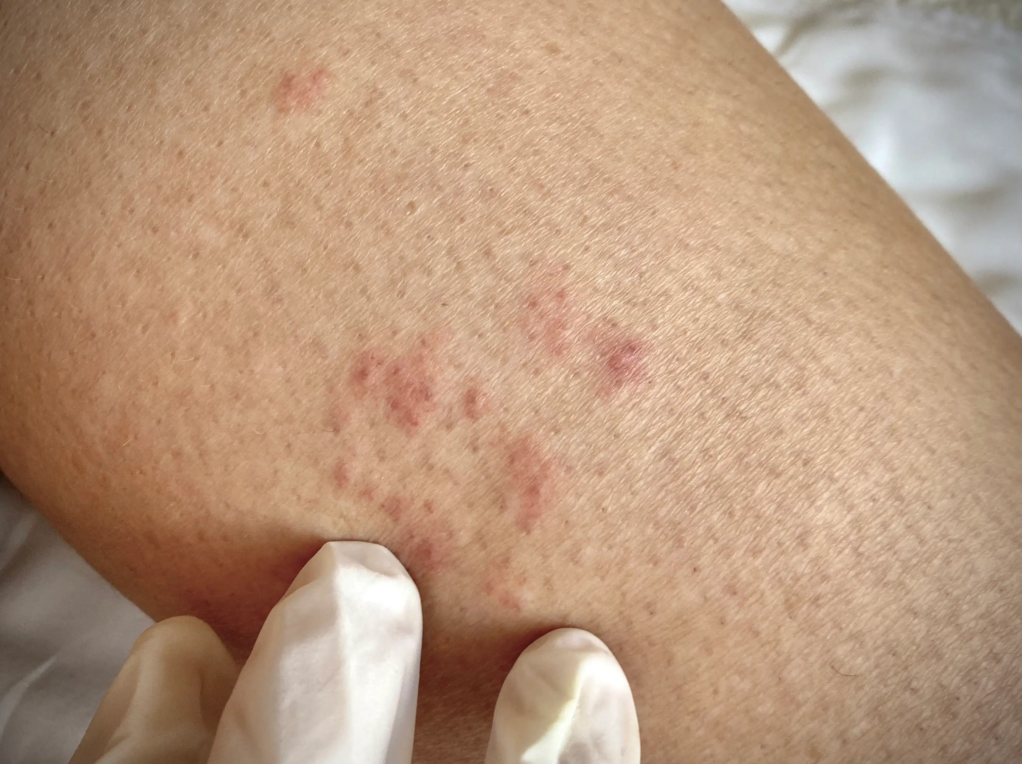 He says rashes can appear for a number of reasons (Getty Stock)